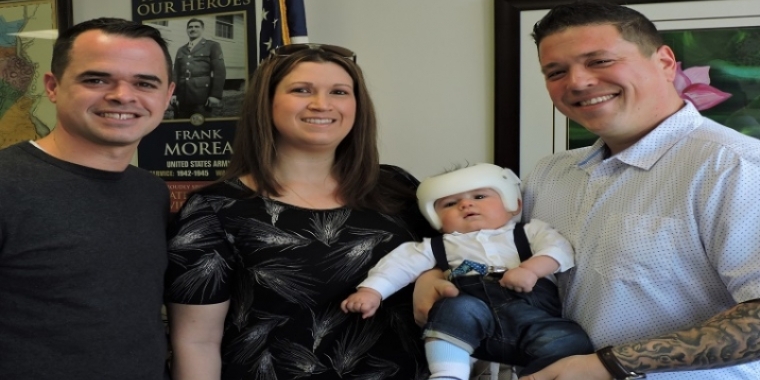 Little Boy Gets Cranial Helmet 